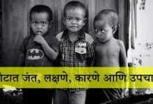 Photo of पोटातील जंत होणे घरगुती उपचार – Jant Gharguti Upay